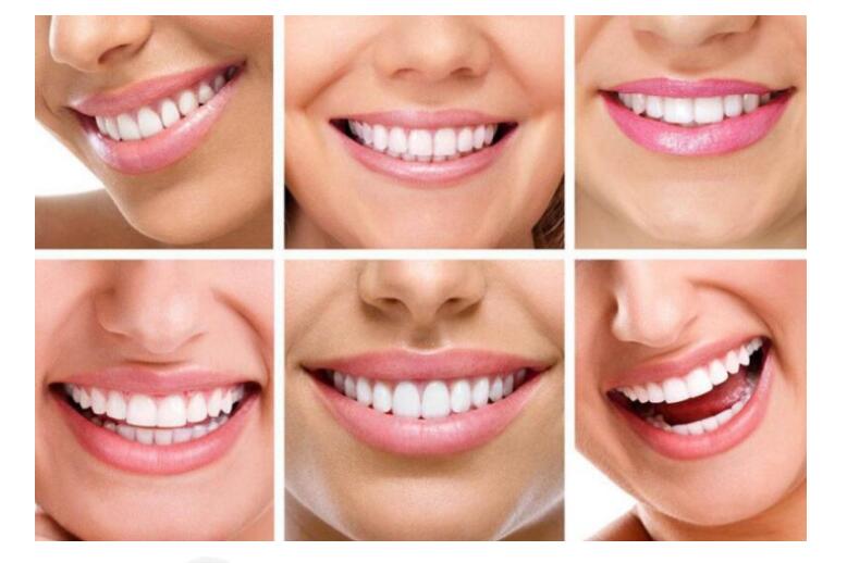 Teeth Whitening Powder